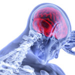 Why do I Need a Lawyer in Denver After a Brain Injury?